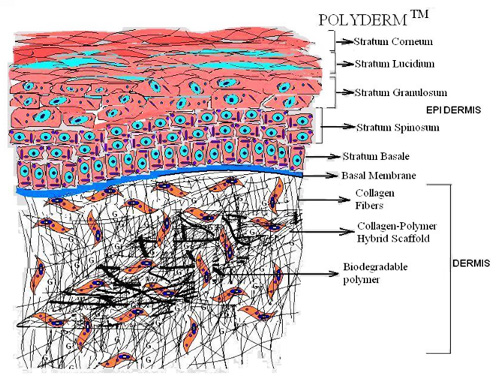 Figure 2. Schematic of Polyderm™.
